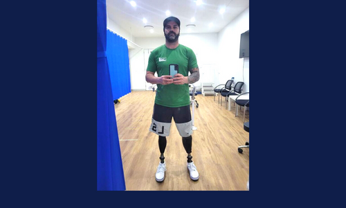 Man with prosthetic legs standing in gym
